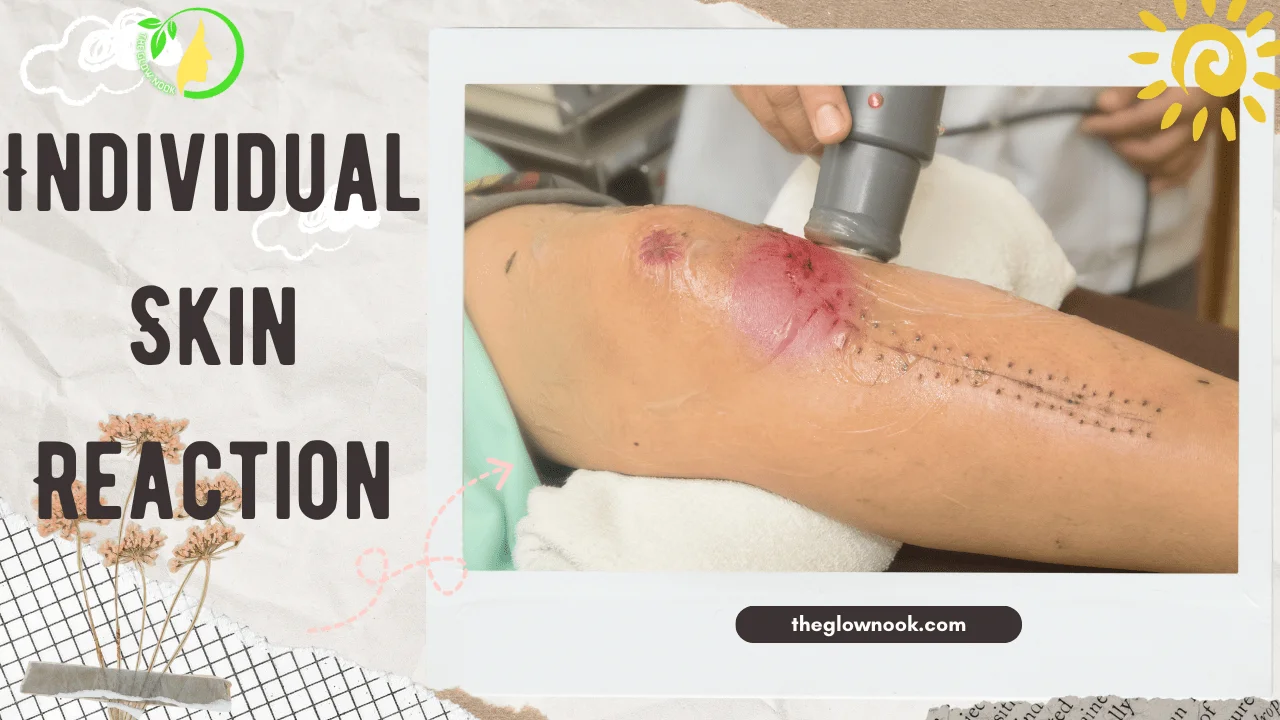 Individual Skin Reaction of tattoo removal