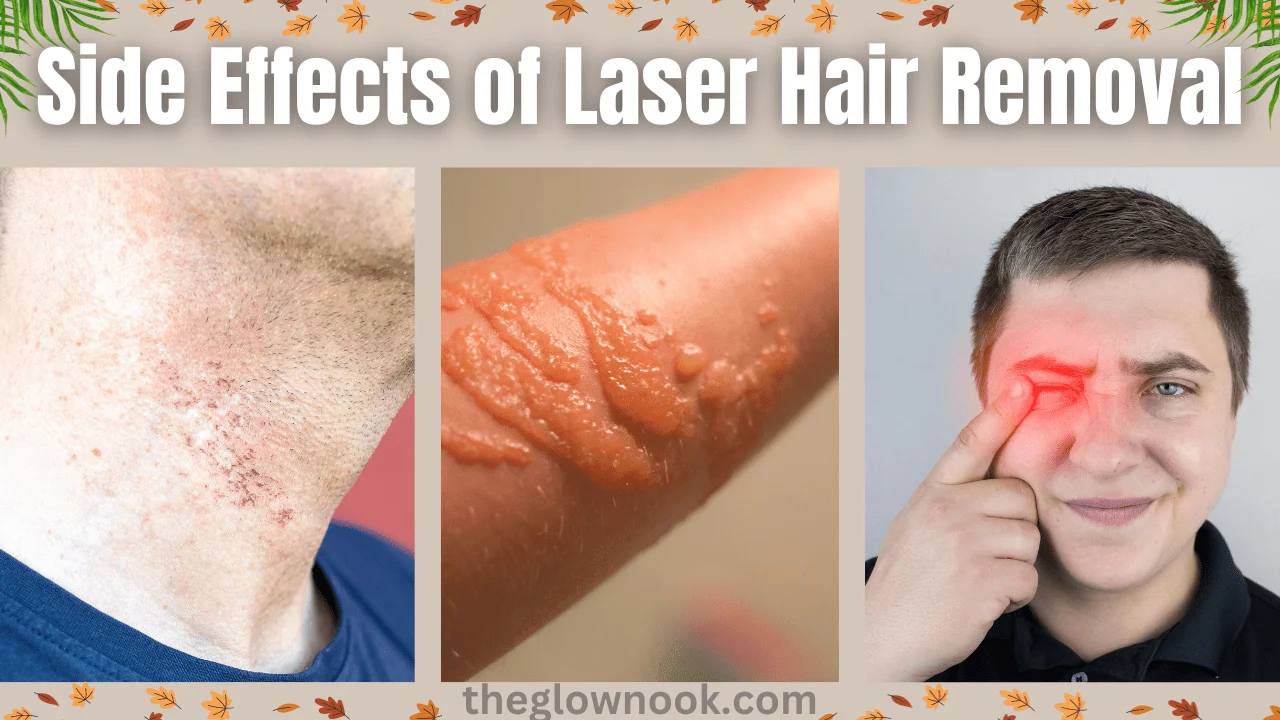 Side Effects of Laser Hair Removal