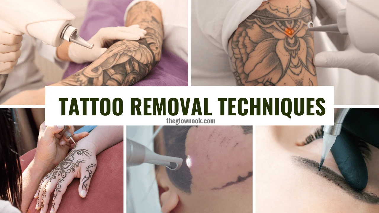 Tattoo Removal Techniques