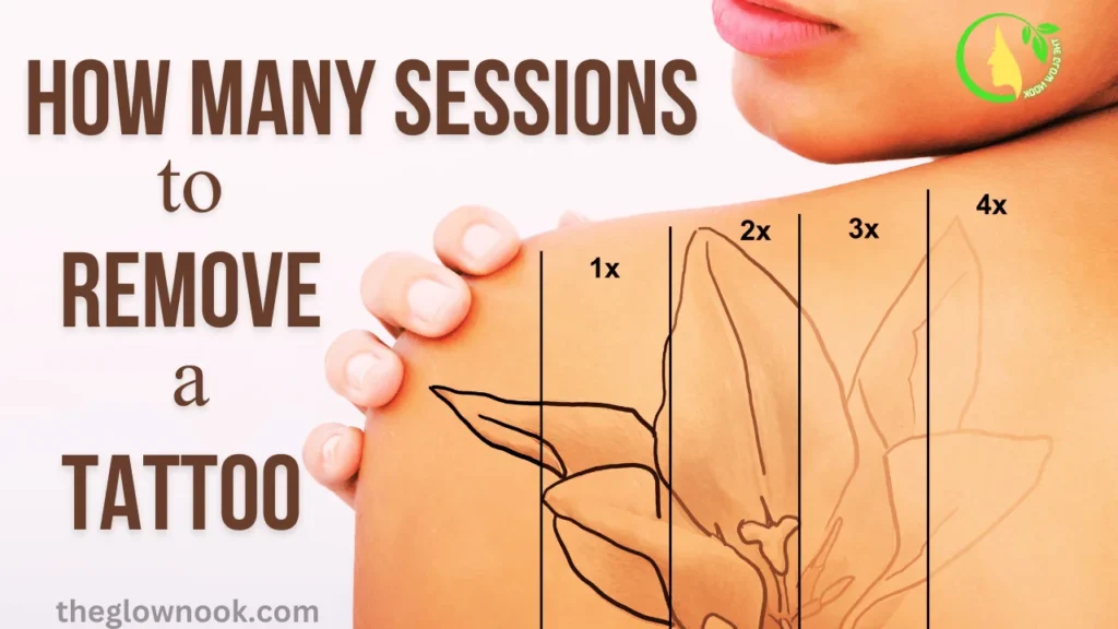 How many sessions to remove a tattoo