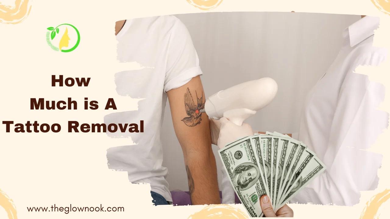 How Much is a Tattoo Removal